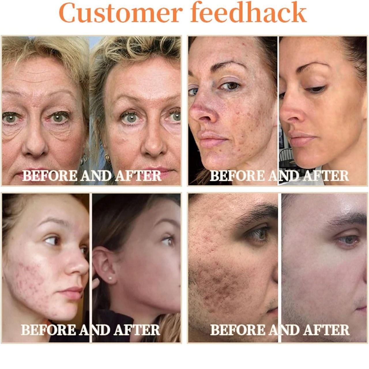 Garagelaine Horse Oil Therepy Cream 240gm Pack of 2